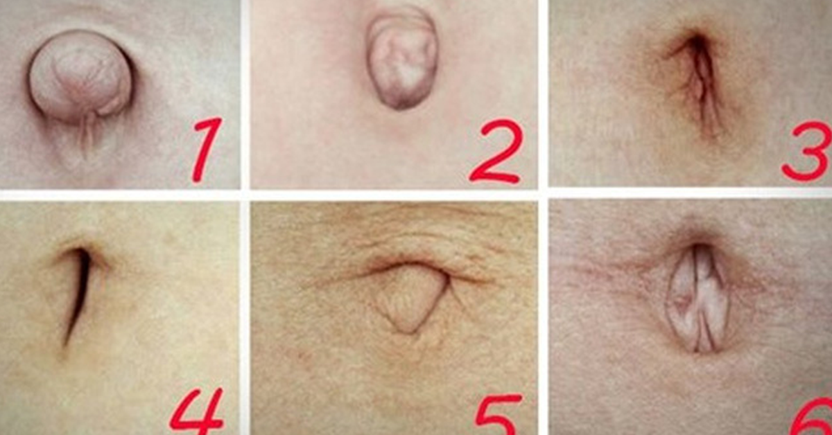 NGƯỜI CÓ TƯỚNG RỐN PHÚ QUÝ THƯỜNG GẶP MAY MẮN VÀ THỊNH VƯỢNG