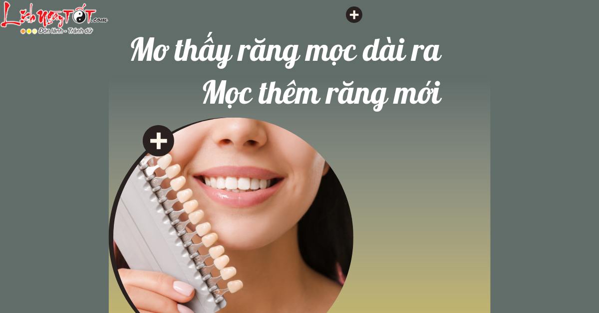 Mo rang moc dai ra hoac moc them rang moi