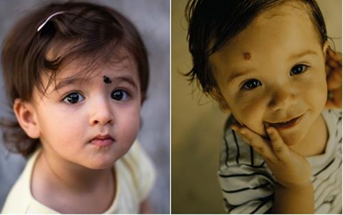 vi tri vet bot tiet lo ve kiep truoc